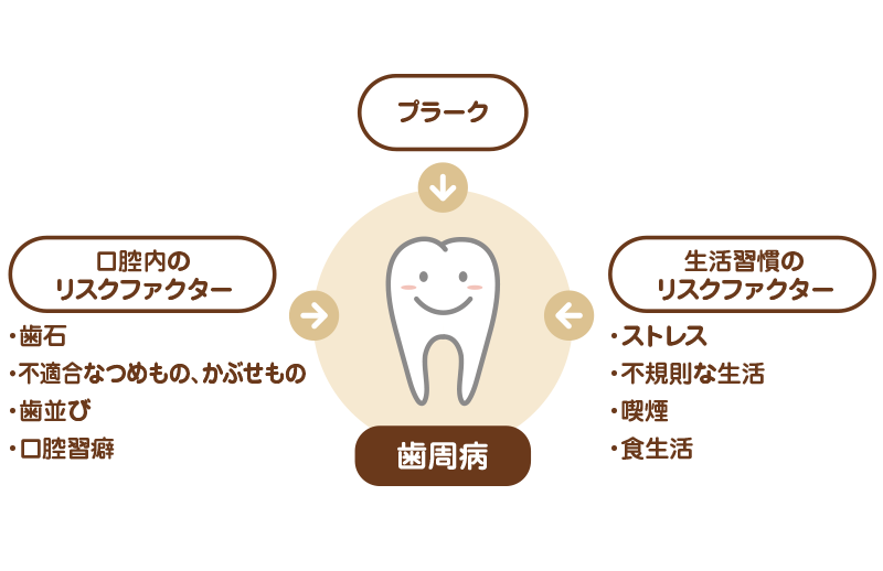 歯周病 歯槽膿漏 の治療 歯周病 歯槽膿漏 の治療 名古屋駅 名駅 の歯科 インプラント 矯正なら みやかわデンタルクリニック 歯周病 歯槽膿漏 の治療 歯周病 歯槽膿漏 の治療 名古屋駅 名駅 の歯科 インプラント 矯正なら みやかわデンタルクリニック