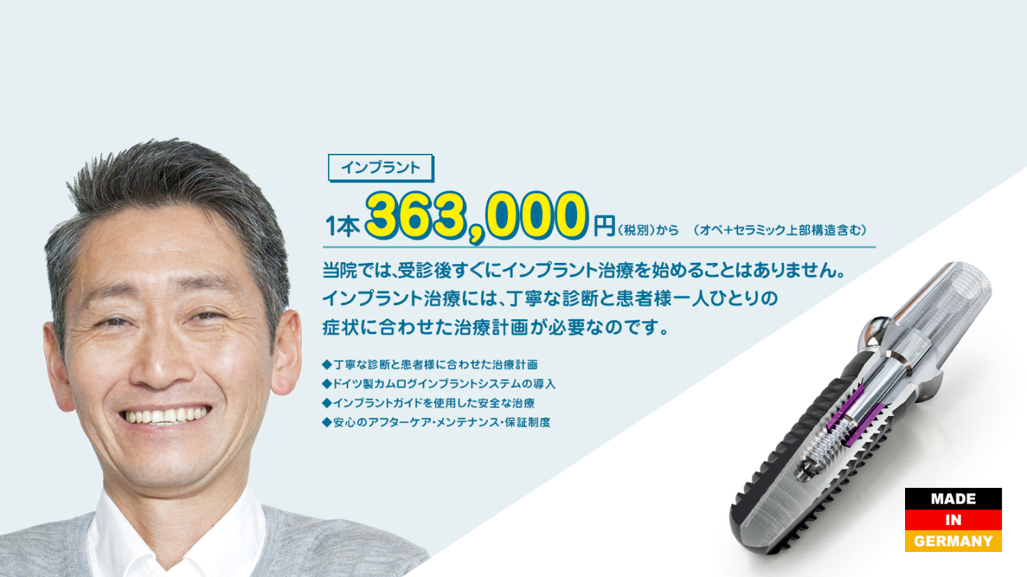 インプラント 1本 363,000円から（税別）（オペ＋セラミック上部構造の費用） 当院では、受診後すぐにインプラント治療を始めることはありません。インプラント治療には、丁寧な診断と患者様一人ひとりの症状に合わせた治療計画が必要なのです。 ◆丁寧な診断と患者様に合わせた治療計画 ◆ドイツ製カムログインプラントシステムの導入 ◆インプラントガイドを使用した安全な治療 ◆安心のアフターケア・メンテナンス・保証制度