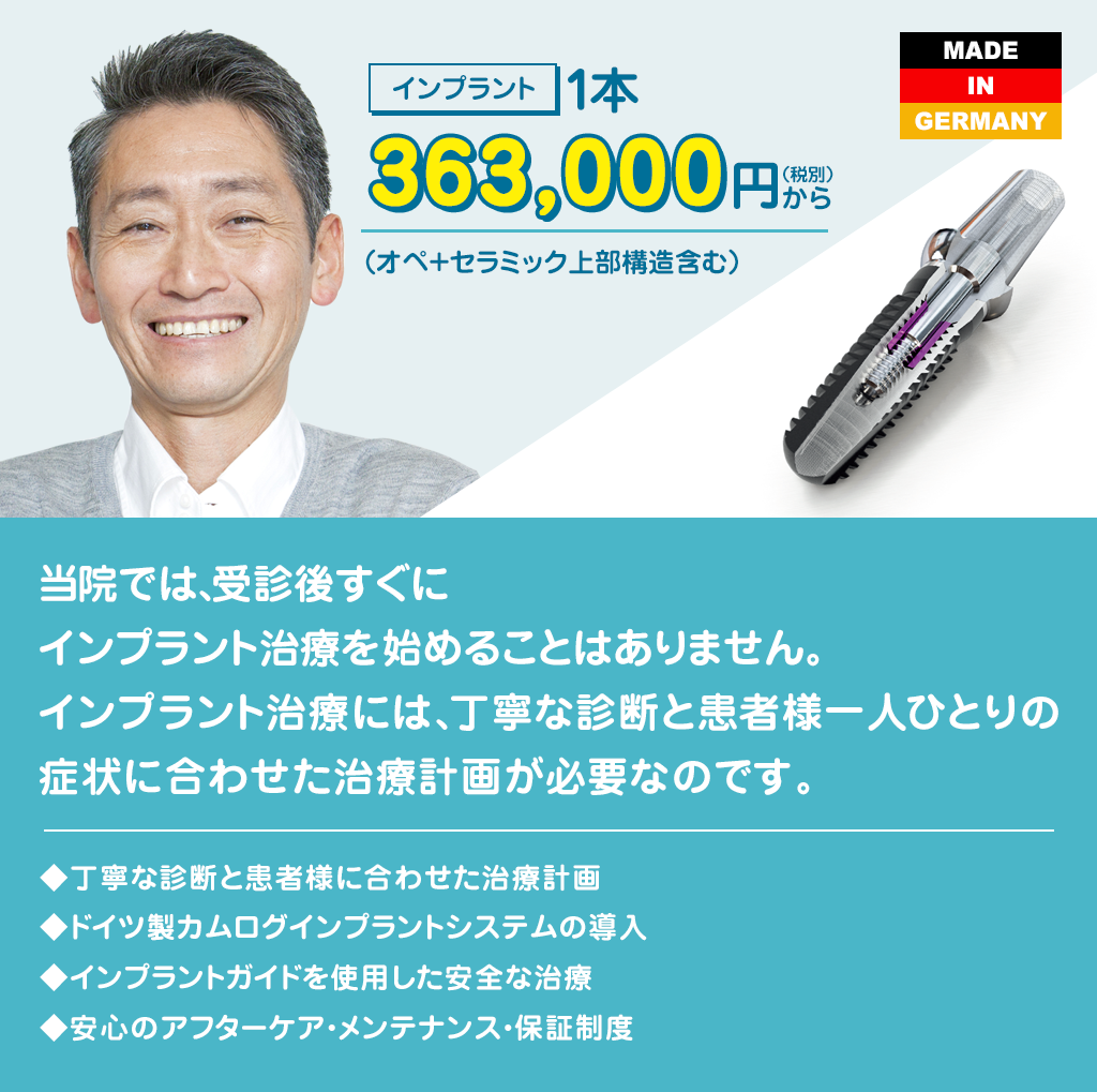 このインプラントなに?他医院で治療されたインプラントへの対応ガイド このインプラントなに?他医院で治療されたインプラントへの対応ガイド