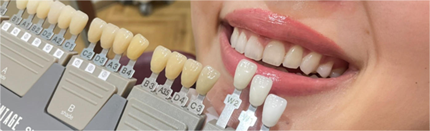 歯の形も顔立ちや周囲の歯に合わせて自然に馴染むように製作するためには、ドクターの診断と優れた技工士の技術が必要です