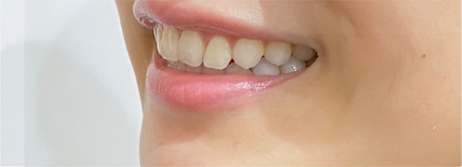 小臼歯と大臼歯