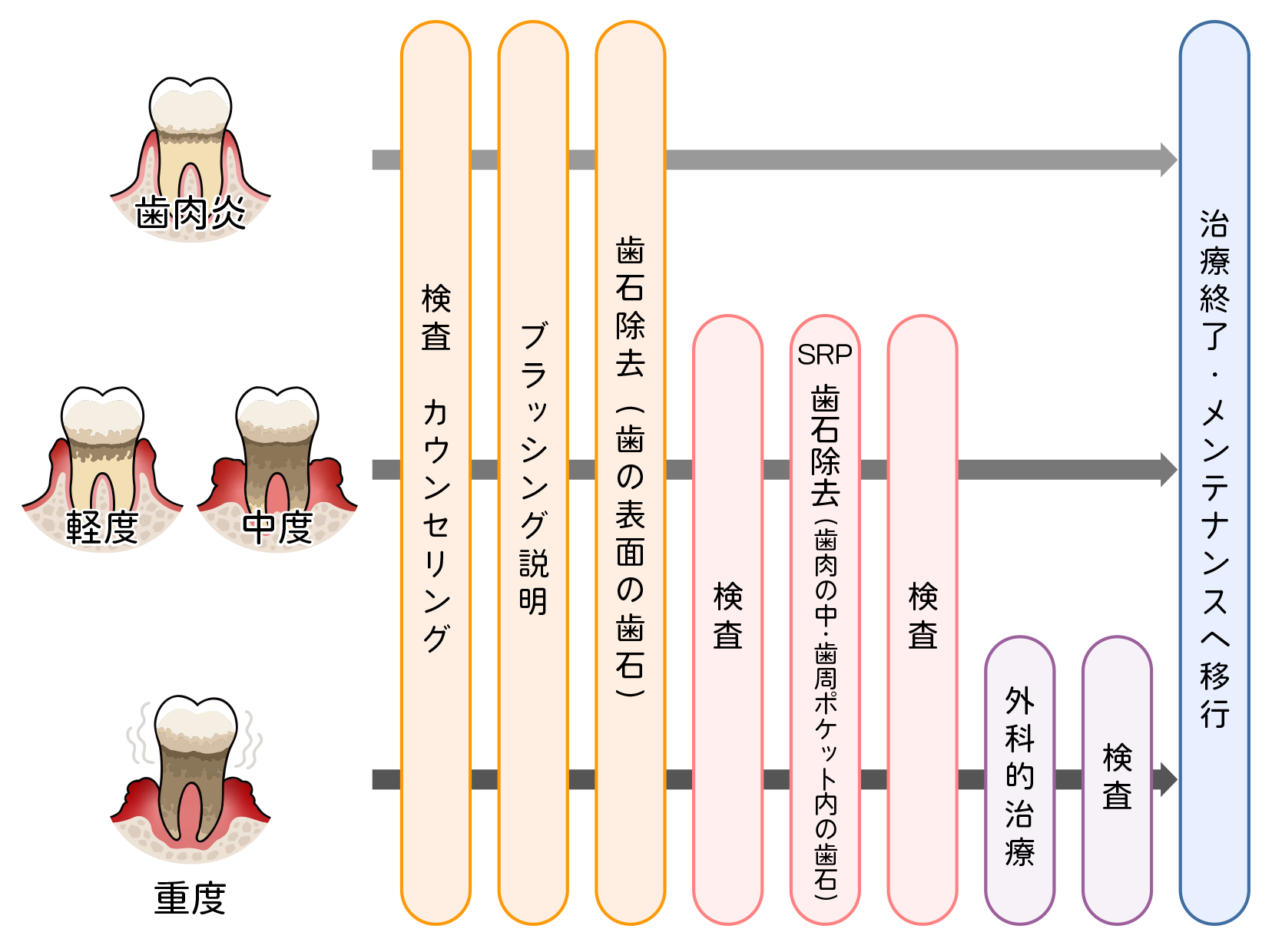 歯周病治療の流れ