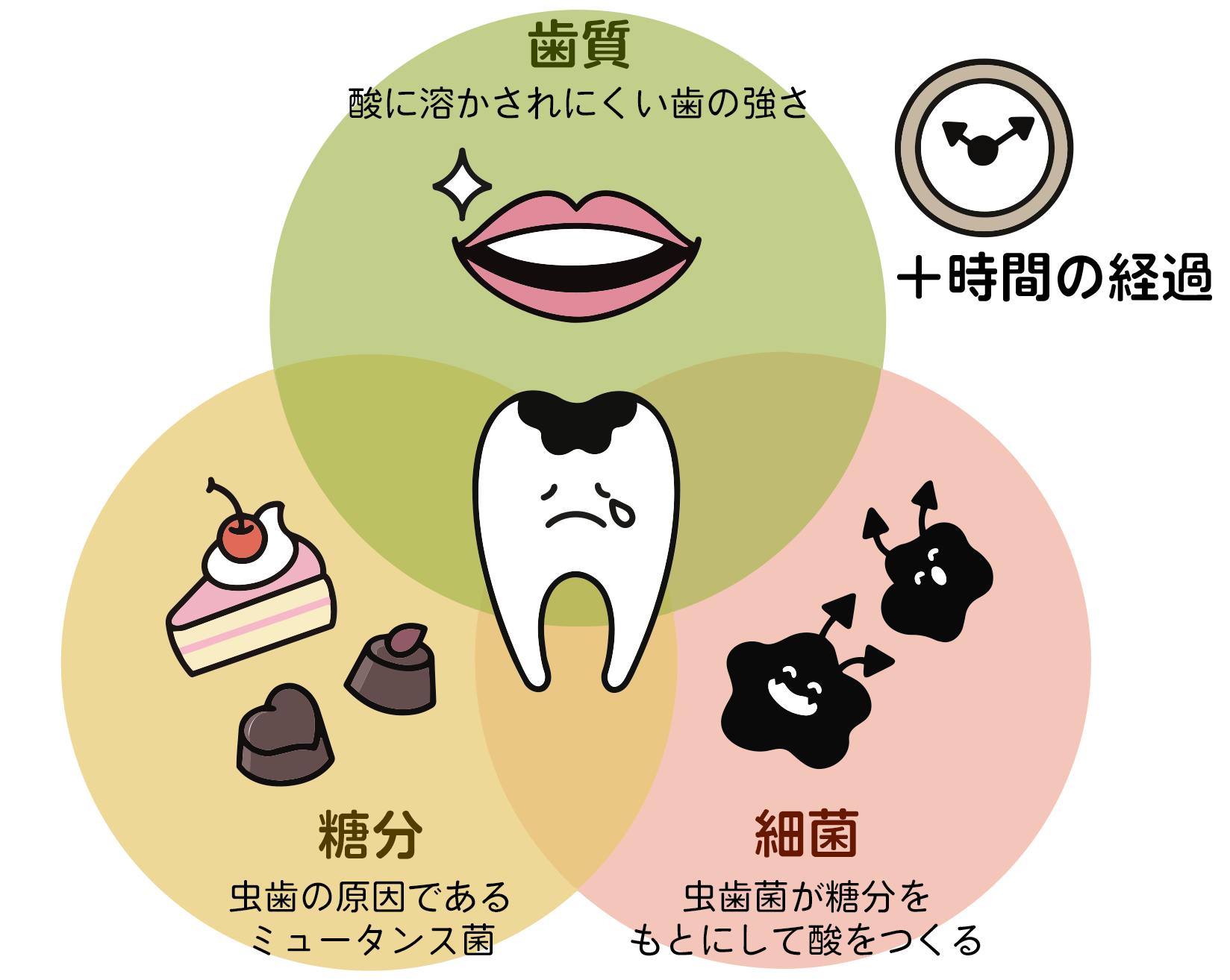 歯質：酸に溶かされにくい歯の強さ、糖分：虫歯の原因であるミュータンス菌、細菌：虫歯菌が糖分をもとにして酸をつくる、＋時間の経過