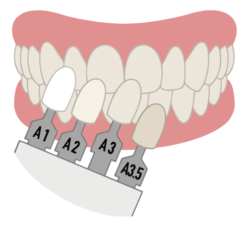 歯の色の確認
